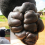 The keloid growth perched on Ochen's ear prior to surgery. Inset: Ochen after the surgery in Kampala.
